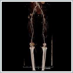 Cardiac and Peripheral Vascular CT